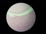 MISSING THUMBNAIL